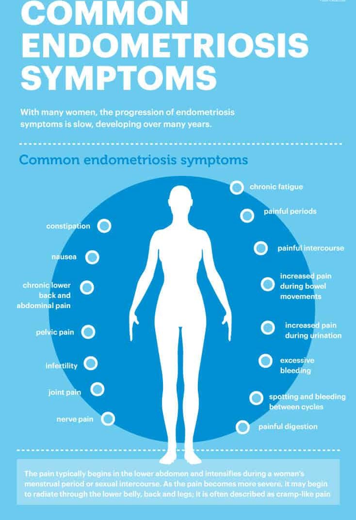 Common endometriosis symptoms - Dr. Axe