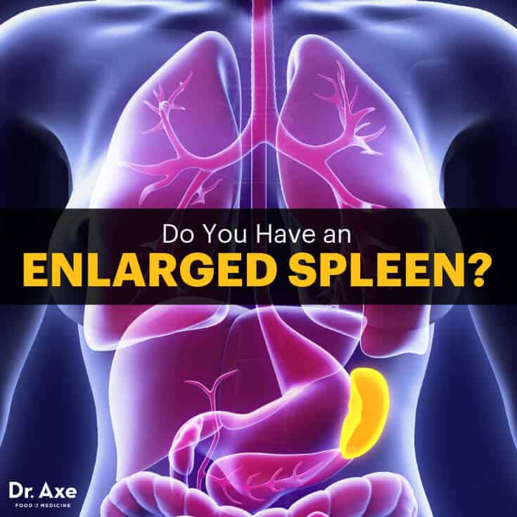 Enlarged spleen - Dr. Axe