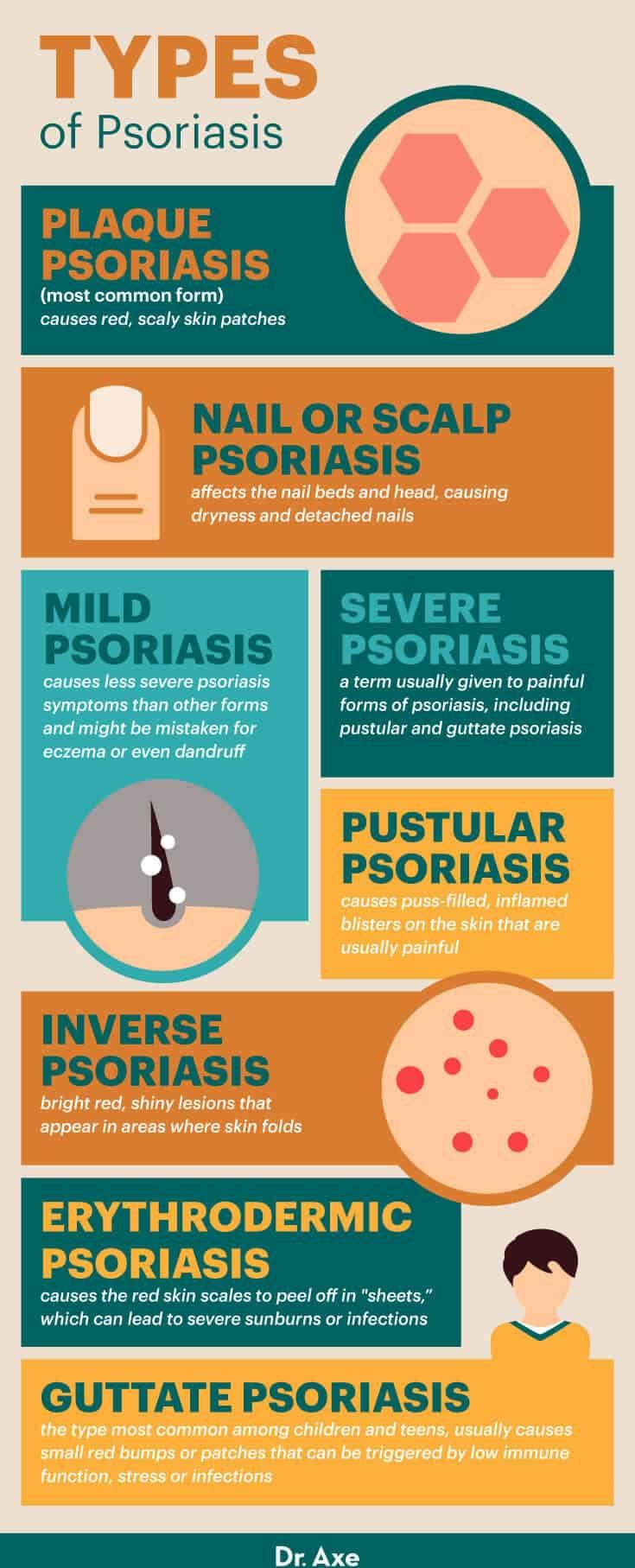 Types of psoriasis - Dr. Axe